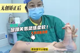 中医外科无创矫正技法给足踝畸形患者带来福音图片