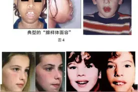 鼻炎、腺样体肥大饮食黑名单，我帮你梳理好了！图片
