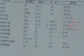 体检发现胆红素增高怎么办？要从哪些地方找问题？医生全部告诉你图片