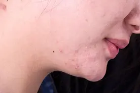 被妇科病缠上的女人，脸上通常会有3种症状图片