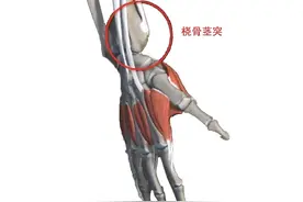 勤劳与爱之名“妈妈手”：桡骨茎突狭窄性腱鞘炎图片