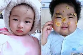 小萝莉患病后像换了个人一样，父母成天以泪洗面，所有人看了心疼图片