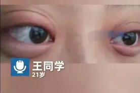女生分手哭3小时眼睛肿成悲伤蛙，画面超级搞笑！图片
