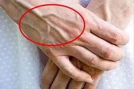 为何有人手臂“青筋暴起”，有的人却看不到“青筋”，看完明白了图片
