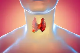 萝卜是结节的“催化剂”吗？医生：不想结节癌变，少吃3物图片