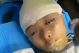 女学生头部被男老师打重伤，情况非常严重，揭露老师及学校的黑心图片