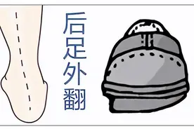 自查：鞋底磨损形状！藏在孩子鞋底的健康问题，小心足外翻图片