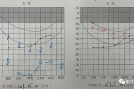江津惠耳听力分享：助听器这么贵，我只买一个能听到就行，可以吗图片