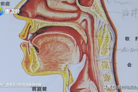 感染新冠后咽喉“如刀割” 用高渗盐水漱口真的有用！图片