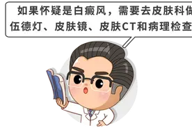 同样是白斑，白色糠疹和白癜风如何区分？图片