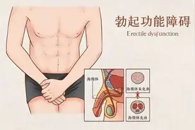 关爱男性健康丨勃起功能障碍的治疗图片