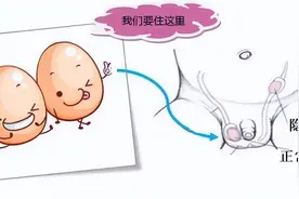 什么是隐睾？能治愈吗？它会造成男性不育吗？图片