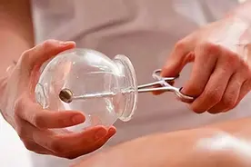 拔火罐后，吸出来的瘀血是毒素吗？医生说出真相，望周知图片