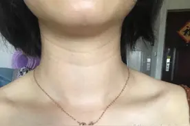 颈纹的不同等级，出现的原因，该如何护理颈部皮肤图片