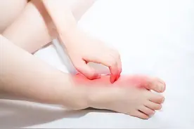 “脚气”真菌怎么治才能根除？3个简单小方法，彻底治好不复发！图片