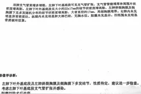58岁的她肺结节超过20mm，做了穿刺活检后，查出了中分化肺腺癌图片
