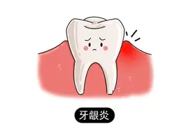 牙龈出血怎么办？一文读懂牙龈出血的7大原因和对策！建议收藏图片