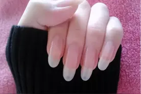剪指甲的一个错误习惯，让很多人痛苦不堪，该怎么剪？图片