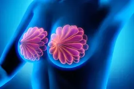 乳腺增生和乳腺结节，到底是什么关系？图片