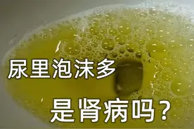 尿里泡沫多，是有肾病吗？医生说：考虑肾病，做3个检查图片