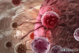 45岁女子长期腿痛，查出宫颈癌晚期，提醒：3个暗示信号别忽视图片