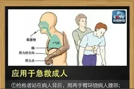 险！2岁女童异物卡喉，“大白”一招救回！这种急救法每人都应该学会…图片