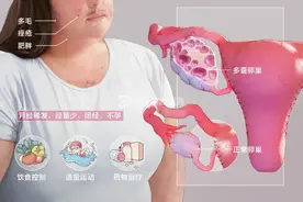不避孕却总怀不上！医生：这种体质很多女生都有图片