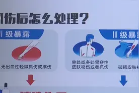动物咬伤怎么办？三级暴露会区分图片