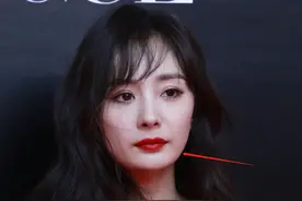 明星整牙后遗症：杨幂脸部松弛，王嘉尔颧骨外扩，宋祖儿法令纹深图片