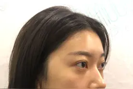 垫眉弓后气质大变，看着凶，是为哪般？图片