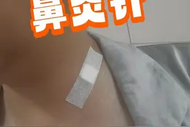 37岁的她去打了鼻炎针，打完针之后非常完美，但只持续了7.5天图片