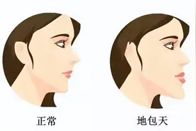堪比整容！牙齿矫正之后居然可以这么美图片
