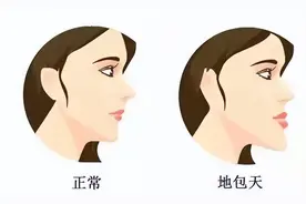 堪比整容！牙齿矫正之后居然可以这么美图片