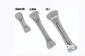 @家长们，决定孩子能长多高的关键因素，骨龄到底“测”了个啥？图片