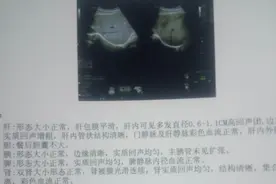一文读懂：肝活检，其实没有那么可怕图片