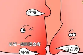 痔疮出血该如何处理？图片