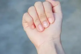 为什么有的人指甲上有月牙，有的人却没有？看完涨知识了图片