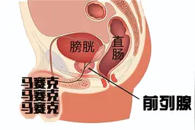 10个男子汉9个都有过这样的“男”言之隐？究竟哪里出了问题？图片