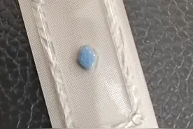与女友第一次，吃了2粒西地那非，感到很不适，副作用会这么大吗图片