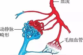 动静脉畸形诊断与治疗（临床问与答）图片