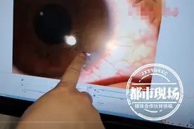 吓人！10岁男孩自制弹弓，竟意外射穿了自己的眼角膜图片