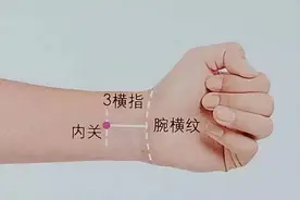 针灸单穴治急症 | 心律失常 首选内关图片