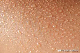 爱出头汗是肾虚？中医：可能跟3个原因有关，教你1招搞定它！图片