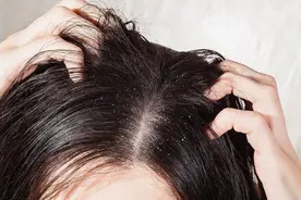 头皮上，总是长疙瘩和脓包，是怎么回事？是病吗？告诉你答案图片