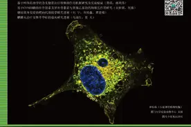 胶质瘤与免疫系统关系及治疗方案图片