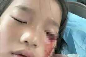 江苏13岁男孩故意打瞎女童眼睛后续！有免罪金牌，不赔钱，不立案图片