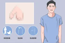 包皮过长怎么办？包皮过长具体需要做哪些检查？图片