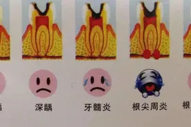 为什么补了牙之后更疼？图片