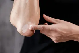 农村野菜马齿苋煮水，能治白癜风吗？真相来了图片