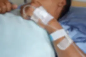 54岁男子确诊口腔癌，提醒：口腔溃疡出现4个特征，及时检查图片